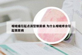 喉咙痛引起点滴型银屑病 为什么喉咙疼会引起银屑病