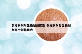 免疫制剂与生物制剂区别 免疫制剂和生物制剂哪个副作用大