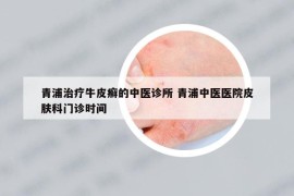 青浦治疗牛皮癣的中医诊所 青浦中医医院皮肤科门诊时间