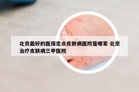 北京最好的医保定点皮肤病医院是哪家 北京治疗皮肤病三甲医院