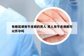 有糖尿病有牛皮癣的男人 男人有牛皮病癣可以怀孕吗