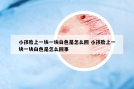 小孩脸上一块一块白色是怎么回 小孩脸上一块一块白色是怎么回事