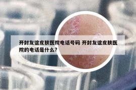 开封友谊皮肤医院电话号码 开封友谊皮肤医院的电话是什么?