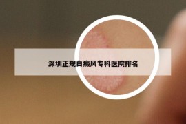 深圳正规白癜风专科医院排名