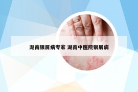 湖南银屑病专家 湖南中医院银屑病