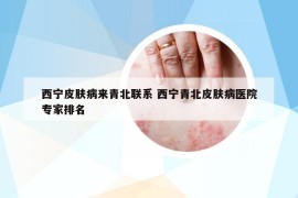 西宁皮肤病来青北联系 西宁青北皮肤病医院专家排名