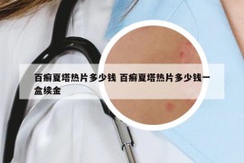 百癣夏塔热片多少钱 百癣夏塔热片多少钱一盒续金