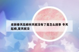 皮肤春天出癣秋天就没有了是怎么回事 冬天起癣,夏天就没