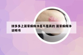 拼多多上苗家癣痒净是不是真的 苗家癣痒净说明书