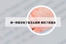 癣一按就没有了是怎么回事 癣扣了就是水