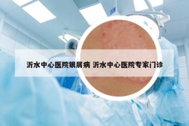 沂水中心医院银屑病 沂水中心医院专家门诊