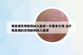 银屑病生物制剂纳入医保一年要多少钱 治疗银屑病的生物制剂纳入医保