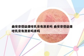 曲安奈德益康唑乳膏有激素吗 曲安奈德益康唑乳膏有激素吗素吗