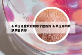 石家庄儿童皮肤病哪个医院好 石家庄哪的皮肤病看的好