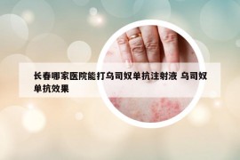 长春哪家医院能打乌司奴单抗注射液 乌司奴单抗效果