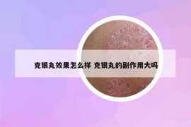 克银丸效果怎么样 克银丸的副作用大吗