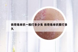 依奇珠单抗一般打多少支 依奇珠单抗要打多久