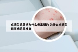 点滴型银屑病为什么老出新的 为什么点滴型银屑病总是反复