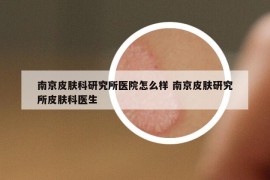 南京皮肤科研究所医院怎么样 南京皮肤研究所皮肤科医生