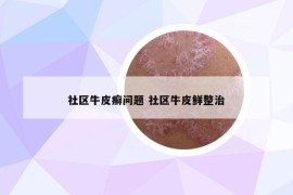 社区牛皮癣问题 社区牛皮鲜整治