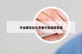 牛皮癣生在头发里行走阅读答案