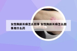 女性胸前长癣怎么回事 女性胸前长癣怎么回事用什么药