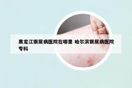 黑龙江银屑病医院在哪里 哈尔滨银屑病医院专科