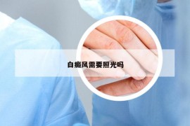 白癜风需要照光吗