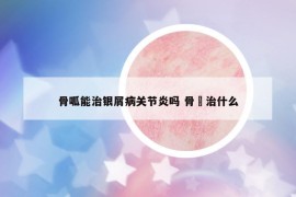 骨呱能治银屑病关节炎吗 骨舦治什么