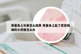 男童身上长癣怎么回事 男童身上起了密密麻麻的小疙瘩怎么办