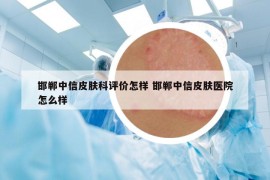 邯郸中信皮肤科评价怎样 邯郸中信皮肤医院怎么样