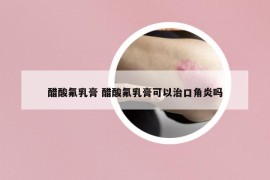 醋酸氟乳膏 醋酸氟乳膏可以治口角炎吗