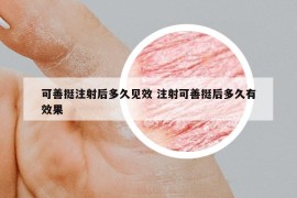 可善挺注射后多久见效 注射可善挺后多久有效果