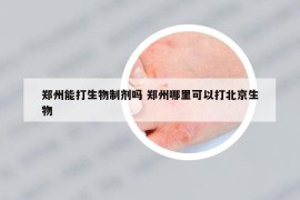 郑州能打生物制剂吗 郑州哪里可以打北京生物