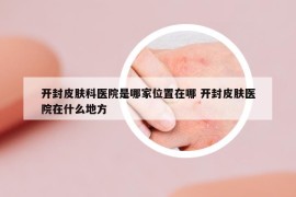 开封皮肤科医院是哪家位置在哪 开封皮肤医院在什么地方