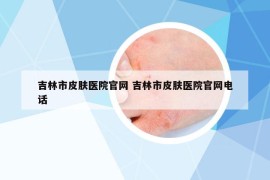 吉林市皮肤医院官网 吉林市皮肤医院官网电话