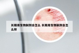 长期用生物制剂会怎么 长期用生物制剂会怎么样