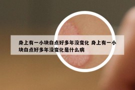 身上有一小块白点好多年没变化 身上有一小块白点好多年没变化是什么病