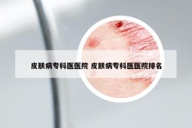 皮肤病专科医医院 皮肤病专科医医院排名