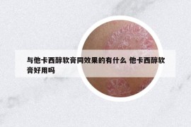 与他卡西醇软膏同效果的有什么 他卡西醇软膏好用吗