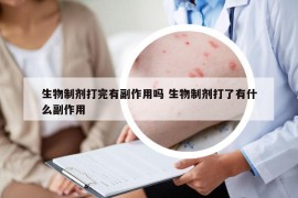 生物制剂打完有副作用吗 生物制剂打了有什么副作用