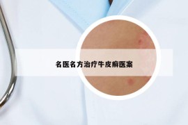 名医名方治疗牛皮癣医案