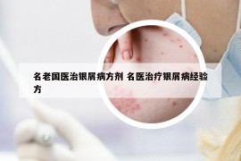 名老国医治银屑病方剂 名医治疗银屑病经验方