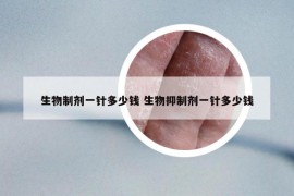 生物制剂一针多少钱 生物抑制剂一针多少钱