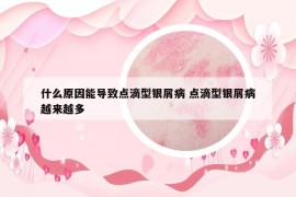 什么原因能导致点滴型银屑病 点滴型银屑病越来越多