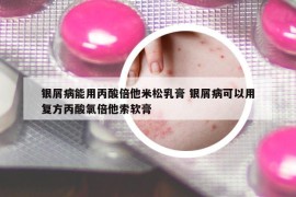 银屑病能用丙酸倍他米松乳膏 银屑病可以用复方丙酸氯倍他索软膏