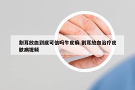 割耳放血到底可信吗牛皮癣 割耳放血治疗皮肤病视频