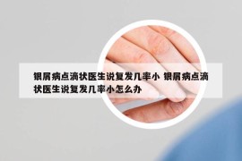 银屑病点滴状医生说复发几率小 银屑病点滴状医生说复发几率小怎么办