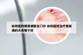 协和医院银屑病联合门诊 协和医院治疗银屑病的大夫哪个好