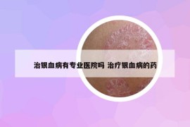 治银血病有专业医院吗 治疗银血病的药